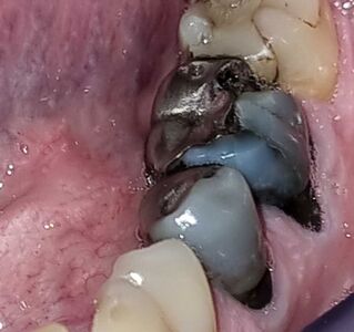 31284 Hg%2Bwb Dd4cfe8c